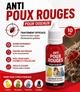 EXZOLT 10 ML